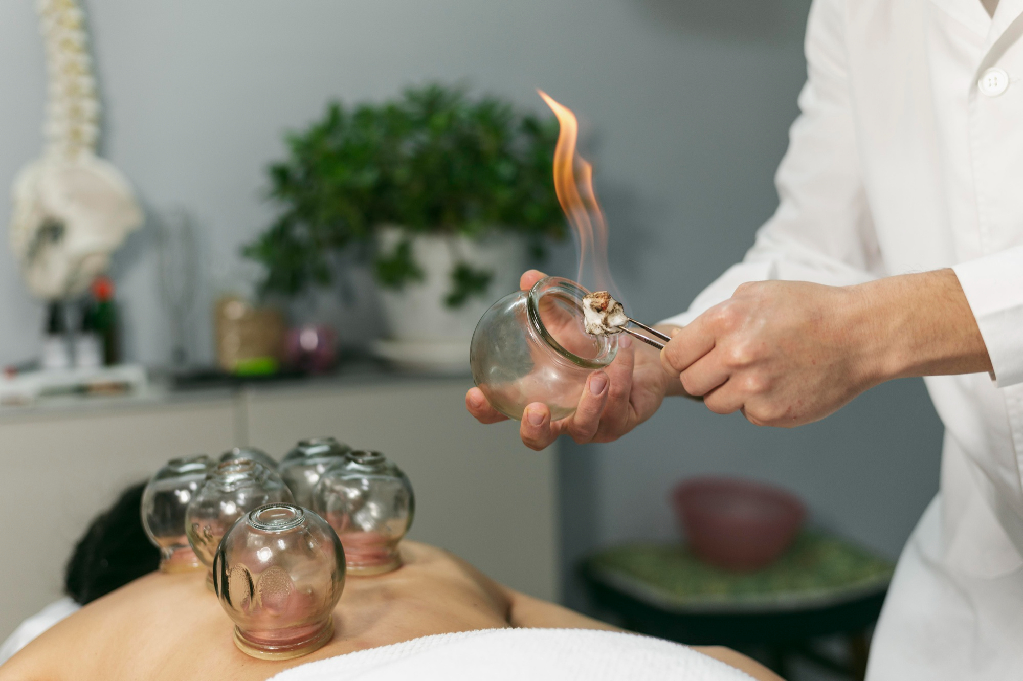 Cupping therapy